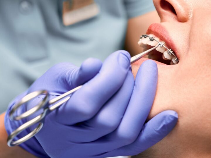 Kiedy i dlaczego warto rozważyć leczenie ortodontyczne
