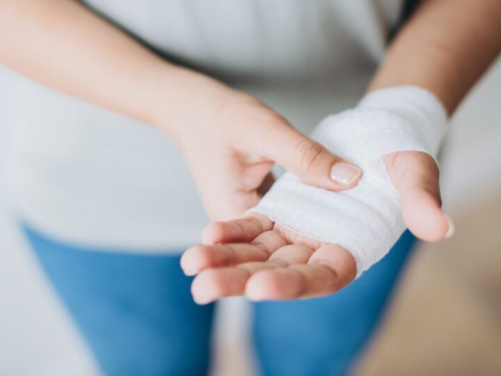 Jak radzić sobie z oparzeniami? Co przyniesie ulgę?